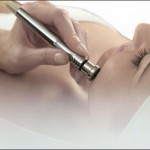 microdermoabrasion